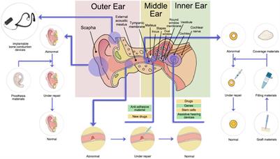 Application of New Materials in Auditory Disease Treatment